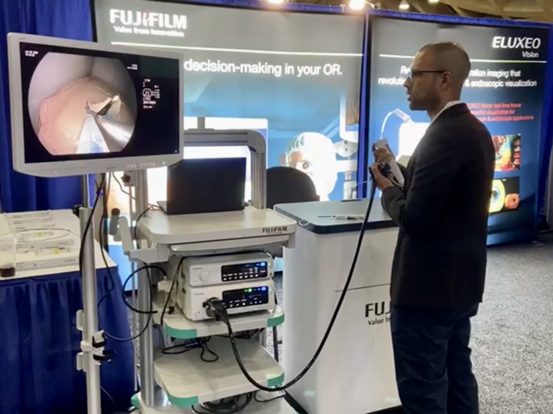 Endoscopia avanzada — Fujifilm Eluxeo
